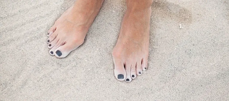 DER KOMFORT-SCHUH BEI HALLUX VALGUS Hallux Valgus